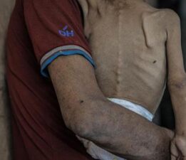 BM’den Gazze için bir uyarı daha: Çocuklar açlıktan eriyor