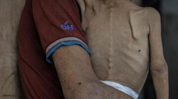 BM’den Gazze için bir uyarı daha: Çocuklar açlıktan eriyor