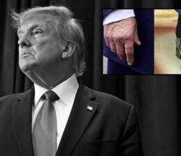 GÜNLERDİR KONUŞULUYORDU: ABD BAŞKANI TRUMP’IN GİZEMLİ HASTALIĞI ORTAYA ÇIKTI!