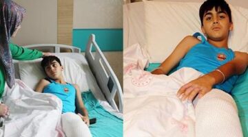 Kolonya şakası dehşete dönüştü: 11 yaşındaki Emir alevler içinde kaldı