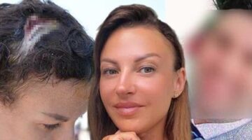 Uzaklaştırma kararı sonrası vahşet! Kafatasına zımba atıldı, elleri kırıldı: Plan yapıp beni öldürmeye geldi