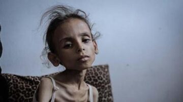 Açlık Gazze’de felaket getirdi: Meryem yürüyemez duruma geldi!
