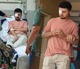 Ahşaptan fırlayan çivi gözüne saplandı: Görme yetisini kaybetti