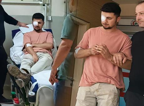 Ahşaptan fırlayan çivi gözüne saplandı: Görme yetisini kaybetti