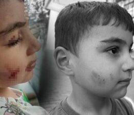 Ankara’da kan donduran olay!: Evde uyuyan çocuğu lağım faresi ısırdı