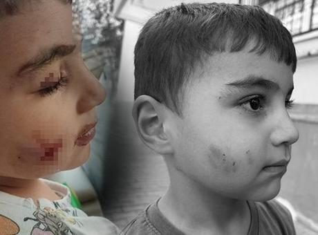 Ankara’da kan donduran olay!: Evde uyuyan çocuğu lağım faresi ısırdı