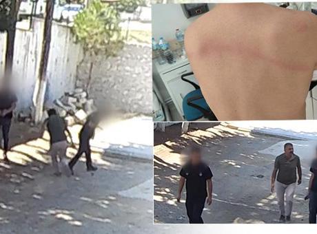 Belediye Başkanından taş döşemek istemeyen zabıta memurlarına dayak: Sırtımda sopanın izleri halen duruyor