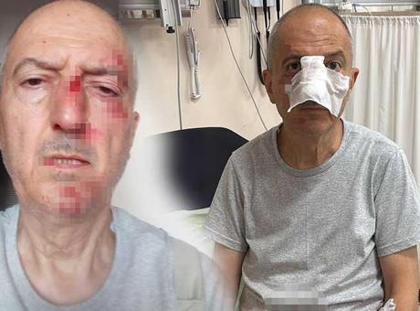 Boşanma aşamasındaki eşinin kardeşi kabusu oldu: Asfalta düştüm