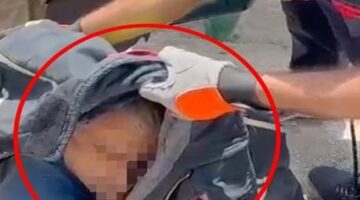 Elazığ’da feci olay! Arkeolojik kazı çalışmalarında başına demir saplandı