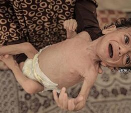 GAZZE’DE ANNELER SÜTTEN KESİLDİ, BEBEKLER ÖLÜMÜN EŞİĞİNDE: NE MAMA VAR NE TEMİZ SU!