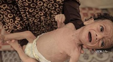 GAZZE’DE ANNELER SÜTTEN KESİLDİ, BEBEKLER ÖLÜMÜN EŞİĞİNDE: NE MAMA VAR NE TEMİZ SU!