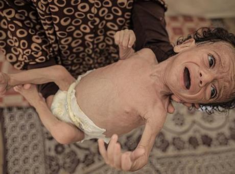 GAZZE’DE ANNELER SÜTTEN KESİLDİ, BEBEKLER ÖLÜMÜN EŞİĞİNDE: NE MAMA VAR NE TEMİZ SU!