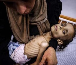 Gazze’de Meryem’in dramı: Fotoğraflar arasında sadece iki gün var!