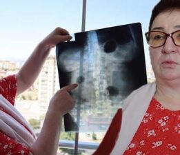 Her şey 6 yıl önce gittiği hastanede ortaya çıktı: 22 yıldır karnında: ‘Canlı bomba gibi geziyorum’
