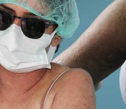 İnternetten sivilceleri için krem siparişi verdi! Ölümden döndü: ‘Kezzap gibi bir ürün’