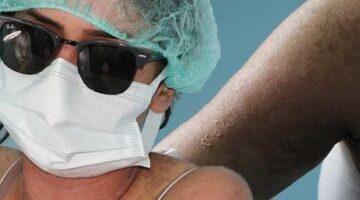İnternetten sivilceleri için krem siparişi verdi! Ölümden döndü: ‘Kezzap gibi bir ürün’