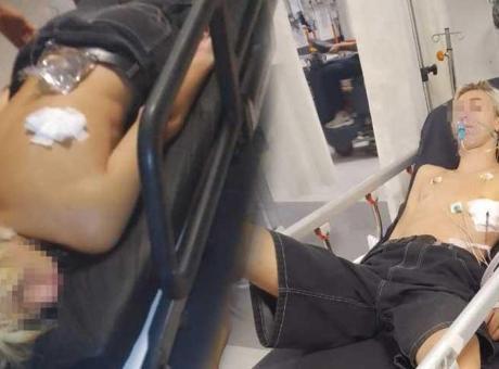 Kuşadası’nda gaspçı dehşeti! 15 yaşındaki çocuk sırtından bıçaklandı