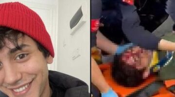 Oyuncu İbrahim Yıldız’ın üzerine ağaç devrildi! Hastaneye kaldırılan oyuncu ölüm kalım savaşı veriyor