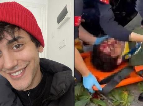 Oyuncu İbrahim Yıldız’ın üzerine ağaç devrildi! Hastaneye kaldırılan oyuncu ölüm kalım savaşı veriyor