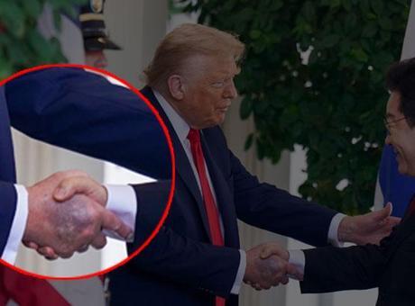 Trump’ın elindeki morluk hakkında Beyaz Saray’dan açıklama
