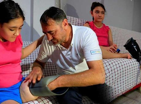 13 günlükken bacağını kaybetti! Özge için 24 saatte gerçekleşen mucize