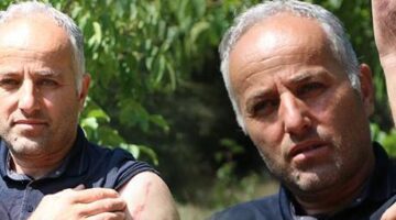 Ayı kabusları oldu! Babasının yüzü parçalandı, oğlunun parmağı koptu