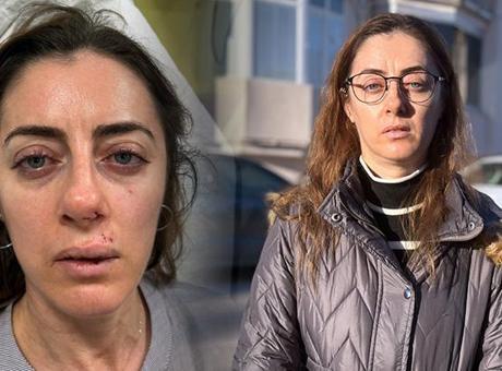 Eşinin sevgilisine benzetti, kabusuyaşattı! ‘Otomobil kapısı’ silah sayıldı