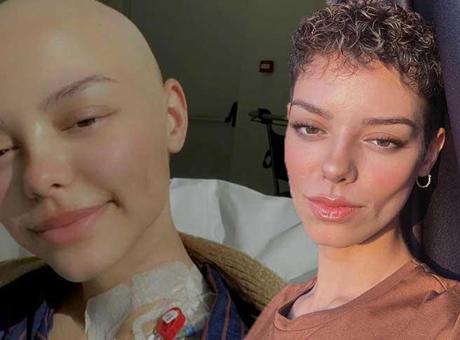 ‘Keloğlan’ yakıştırmasıyla videolar çekti! 100 kemoterapi, 5 büyük ameliyat geçirdi: ‘Hayalim karavanla gezmek’